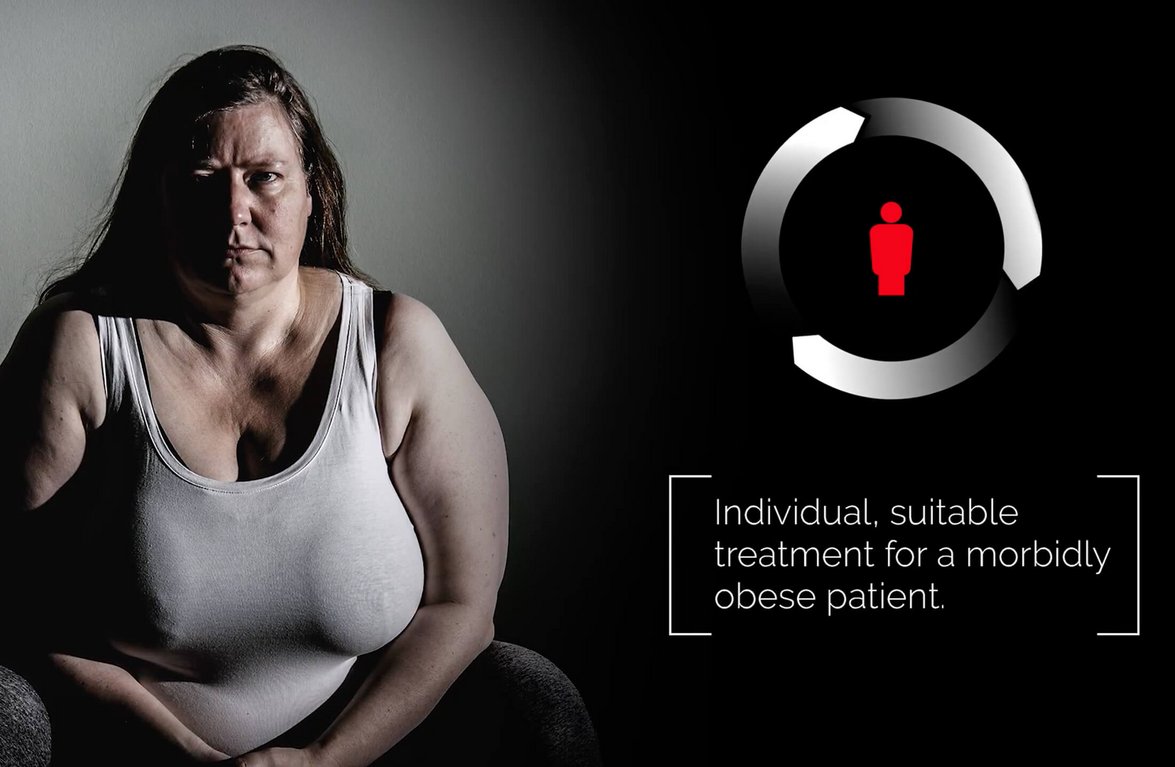 Johnson and Johnson Adipositas Kampagne mit übergewichtiger Frau abgebildet
